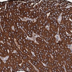 Anti-SECISBP2L antibody produced in rabbit 