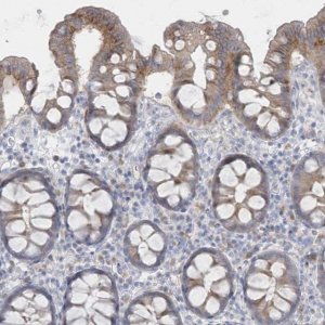 Anti-SEMA3D antibody produced in rabbit 