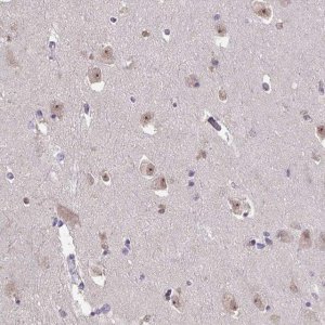 Anti-SENP3 antibody produced in rabbit 
