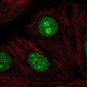 Anti-SENP3 antibody produced in rabbit 