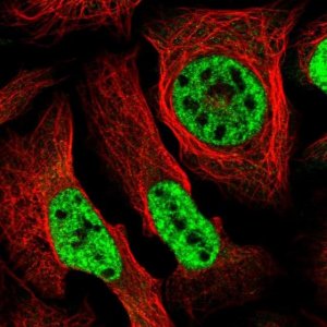 Anti-SEPHS2 antibody produced in rabbit 