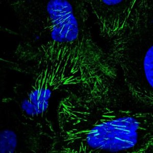 Anti-SEPT9 antibody produced in rabbit 