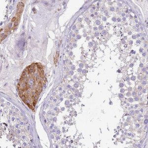 Anti-SERINC3 antibody produced in rabbit 