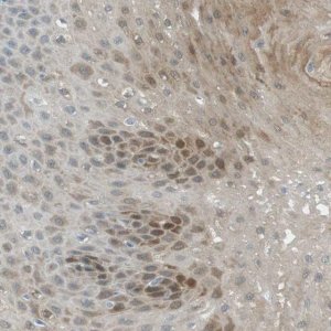 Anti-SERPINB2 antibody produced in rabbit 