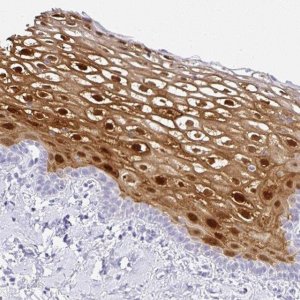 Anti-SERPINB3 antibody produced in rabbit 