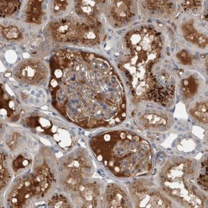 Anti-SERPINC1 antibody produced in rabbit HPA024007-100UL