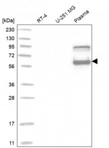 Anti-SERPINC1 antibody produced in rabbit HPA024007-100UL