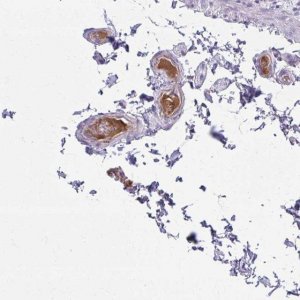 Anti-SERPIND1 antibody produced in rabbit 