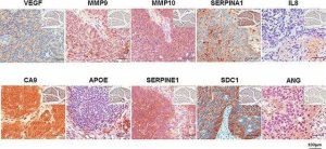 Anti-SERPINE1 antibody produced in rabbit 