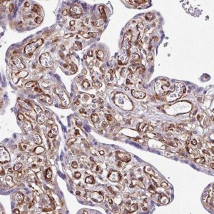 Anti-SERPINE1 antibody produced in rabbit 
