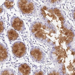 Anti-SERPINE3 antibody produced in rabbit 
