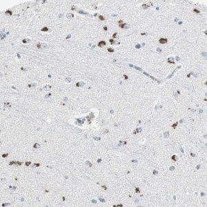 Anti-SERPINF1 antibody produced in rabbit 