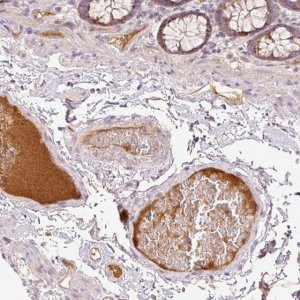 Anti-SERPING1 antibody produced in rabbit 