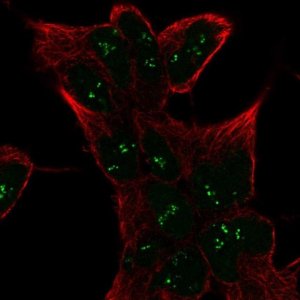 Anti-SESN1 antibody produced in rabbit 