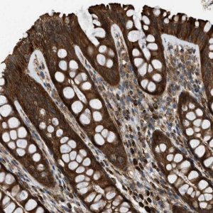 Anti-SESN2 antibody produced in rabbit 