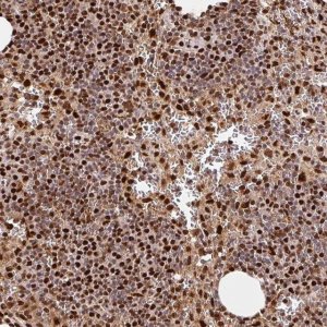 Anti-SET antibody produced in rabbit 