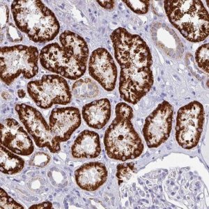 Anti-SETBP1 antibody produced in rabbit 