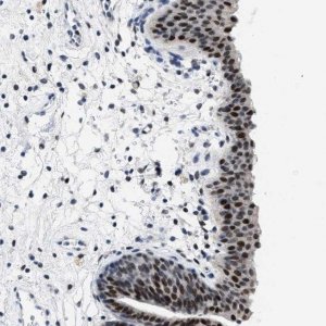 Anti-SETD1B antibody produced in rabbit 