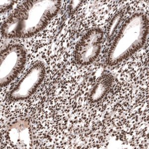 Anti-SETD2 antibody produced in rabbit 