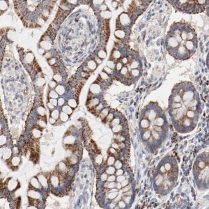 Anti-SETD3 antibody produced in rabbit 