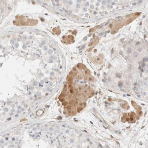 Anti-SETD4 antibody produced in rabbit 