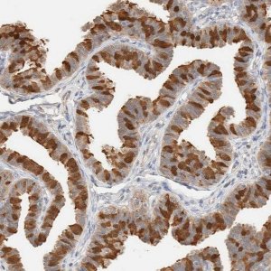 Anti-SETD4 antibody produced in rabbit 
