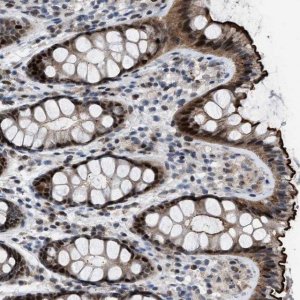 Anti-SETDB1 antibody produced in rabbit 