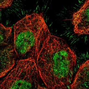 Anti-SETDB1 antibody produced in rabbit 
