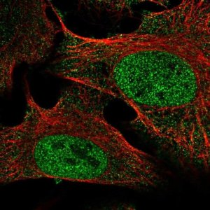 Anti-SETDB2 antibody produced in rabbit 