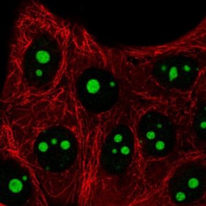 Anti-SETMAR antibody produced in rabbit 