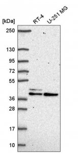 Anti-SETMAR antibody produced in rabbit 