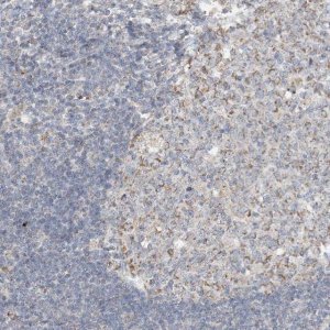 Anti-SFMBT2 antibody produced in rabbit 