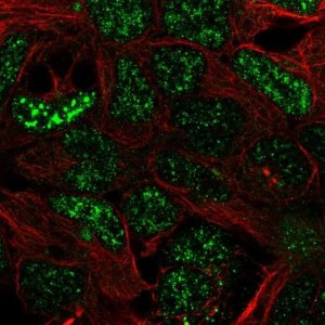 Anti-SFMBT2 antibody produced in rabbit 