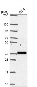 Anti-SFRP1 antibody produced in rabbit HPA064870-100UL