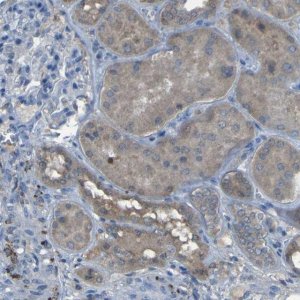 Anti-SGK2 antibody produced in rabbit HPA011387-100UL