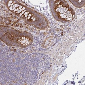 Anti-SGK494 antibody produced in rabbit HPA046590-100UL