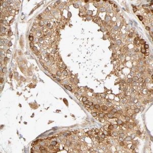 Anti-SGSM1 antibody produced in rabbit 