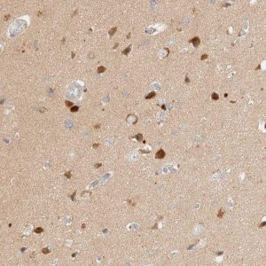 Anti-SGSM2 antibody produced in rabbit 