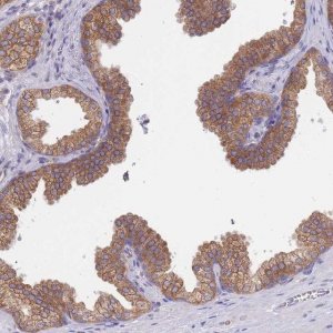 Anti-SH2B2 antibody produced in rabbit 