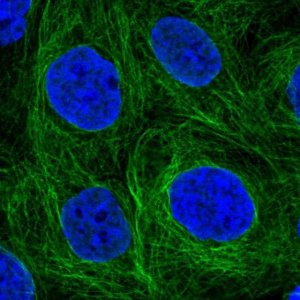 Anti-SH2D3A antibody produced in rabbit 