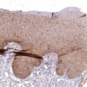 Anti-SH2D3A antibody produced in rabbit HPA035722-100UL