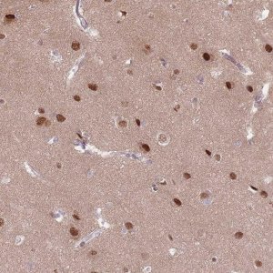 Anti-SH3BGRL2 antibody produced in rabbit 