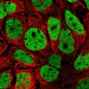 Anti-SH3BGRL2 antibody produced in rabbit 