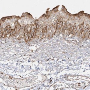 Anti-SH3BP2 antibody produced in rabbit HPA036790-100UL