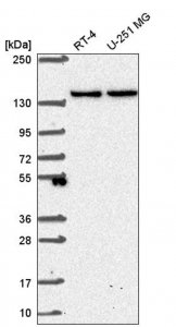 Anti-SH3TC1 antibody produced in rabbit 