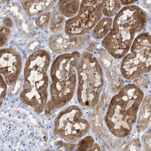 Anti-SH3YL1 antibody produced in rabbit 