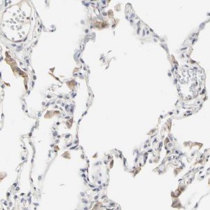 Anti-SHANK2 antibody produced in rabbit 