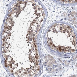 Anti-SHE antibody produced in rabbit 