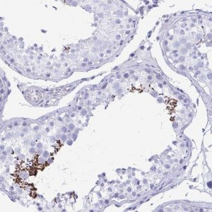 Anti-SHISA8 antibody produced in rabbit 