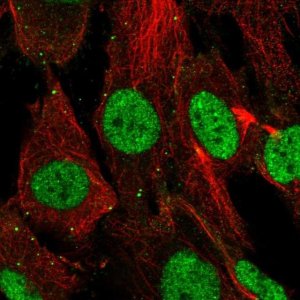 Anti-SHOX antibody produced in rabbit 